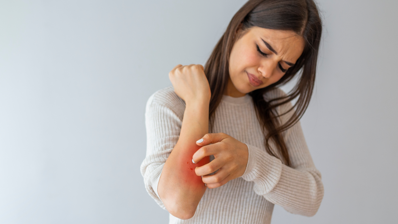 Woman suffering from itching